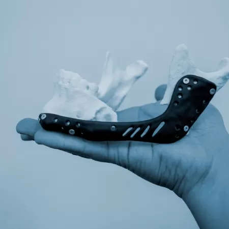 3d Biomedische Prototypeproductie 1