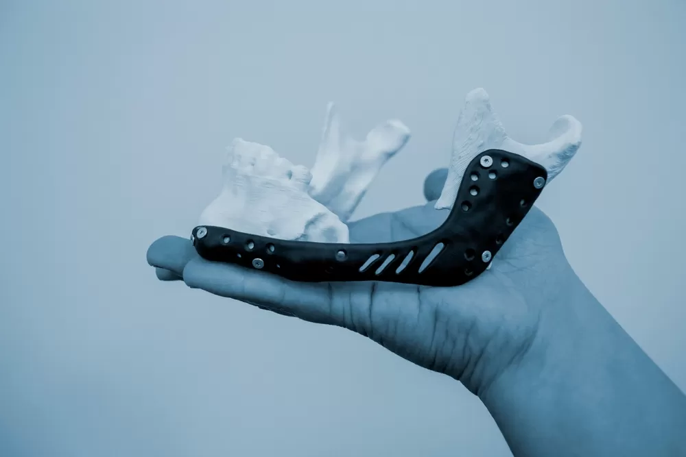 3d Biomedische Prototypeproductie 1