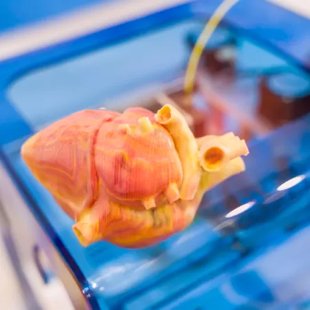 3d Printen Medisch 2