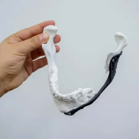 Medische Productontwikkeling Met 3d Printer 2