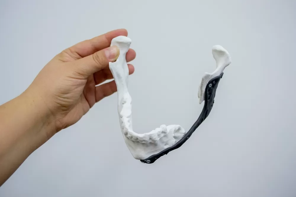 Medische Productontwikkeling Met 3d Printer 2