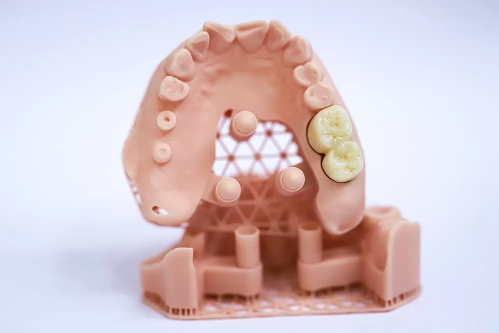 Tandheelkundige 3d Productie 2