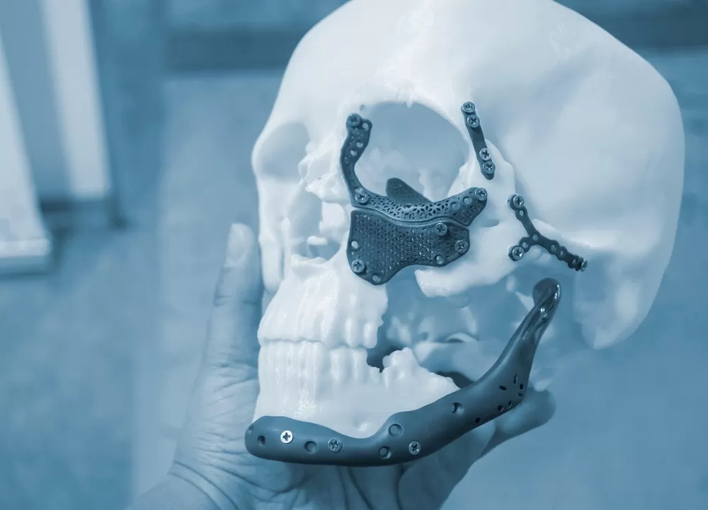 Tandheelkundige 3d Productie 3